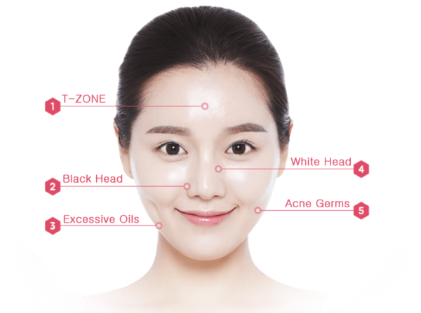 PDT | Renovo Skin Clinic