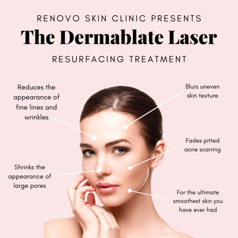 Acne Scarring | Renovo Skin Clinic